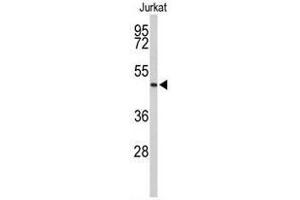 Western blot analysis of ACR Antibody (C-term) in Jurkat cell line lysates (35 µg/lane).