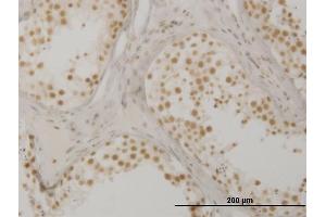 Immunoperoxidase of monoclonal antibody to OXSR1 on formalin-fixed paraffin-embedded human testis. (OXSR1 anticorps  (AA 351-450))