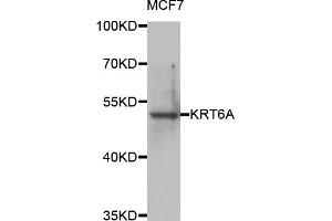 Western blot analysis of extracts of MCF-7 cells, using KRT6A antibody (ABIN5974635) at 1/1000 dilution. (KRT6A anticorps)