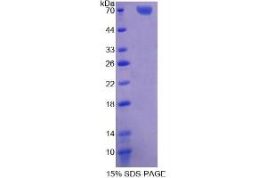 SDS-PAGE analysis of Human TFDP1 Protein. (DP1 Protéine)