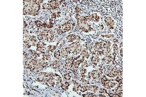IHC analysis of PTBP1 using anti-PTBP1 antibody (ABIN7599451).
