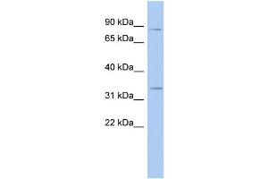 WB Suggested Anti-STX19 Antibody Titration: 0. (Syntaxin 19 anticorps  (N-Term))