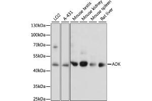 Western blot analysis of extracts of various cell lines, using ADK antibody  at 1:1000 dilution. (ADK anticorps  (AA 200-345))