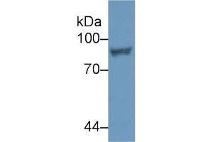 Detection of STAT4 in Human Jurkat cell lysate using Polyclonal Antibody to Signal Transducer And Activator Of Transcription 4 (STAT4)
