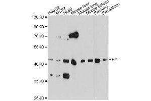 Western blot analysis of extracts of various cell lines, using HP antibody. (Haptoglobin anticorps)