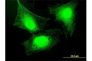Immunofluorescence of purified MaxPab antibody to GBP5 on HeLa cell.