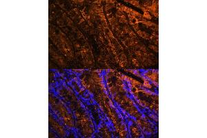 Immunofluorescence analysis of mouse colon using Galectin 4/LG Polyclonal Antibody (ABIN7267339) at dilution of 1:100 (40x lens).