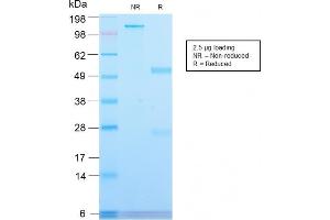 SDS-PAGE Analysis Purified CD71 Rabbit Recombinant Monoclonal Antibody (TFRC/2898R).