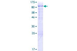 Image no. 1 for RNA Binding Motif Protein 6 (RBM6) (AA 1-601) protein (GST tag) (ABIN1317622)