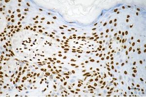 Immunohistochemistry was performed on paraffin-embedded human skin tissue using macroH2A. (Recombinant Histone, H2A1, Macro anticorps)