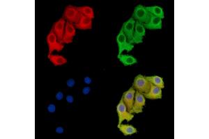 ABIN7096113 and ABIN7100175 staining Hela cells by IF/ICC. (WDR41 anticorps)
