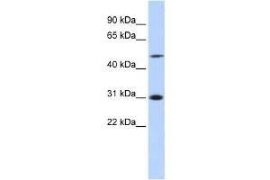 Western Blotting (WB) image for anti-Inhibitor of Growth Family, Member 3 (ING3) antibody (ABIN2458018) (ING3 anticorps)