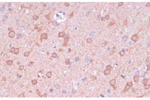Immunohistochemistry of paraffin-embedded Rat brain using TIMM8B Polyclonal Antibody at dilution of 1:100 (40x lens). (TIMM8B anticorps)