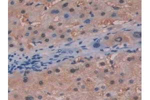DAB staining on IHC-P; Samples: Human Liver Tissue