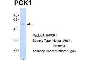 Host:  Rabbit  Target Name:  PCK1  Sample Type:  Human Adult Placenta  Antibody Dilution:  1.