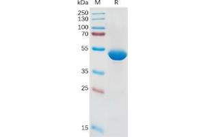 Human IL1B Protein, hFc Tag on SDS-PAGE under reducing condition. (IL-1 beta Protein (Fc Tag))
