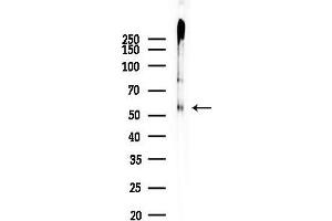 Western blot analysis of lysates from COLO205 cells(heat-shock treatment), using Phospho-c-Myc (Ser62) Antibody at 1/1000 dilution.