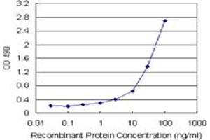 SERPINA3 (Human) Matched Antibody Pair