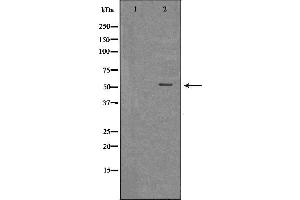 Western blot analysis of extracts of THP-1 , using MLKL antibody. (MLKL anticorps  (Internal Region))