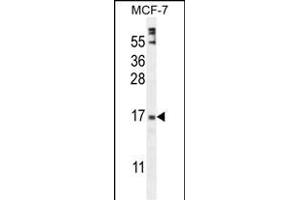 ZN Antibody (Center) (ABIN654974 and ABIN2844614) western blot analysis in MCF-7 cell line lysates (35 μg/lane). (ZNF720 anticorps  (AA 34-62))