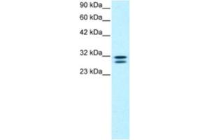 Western Blotting (WB) image for anti-HIV-1 Tat Interactive Protein 2, 30kDa (HTATIP2) antibody (ABIN2460567) (HIV-1 Tat Interactive Protein 2, 30kDa (HTATIP2) anticorps)