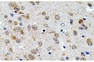 Immunohistochemistry of paraffin-embedded Mouse brain using CAST Polyclonal Antibody at dilution of 1:100 (40x lens). (Calpastatin anticorps)