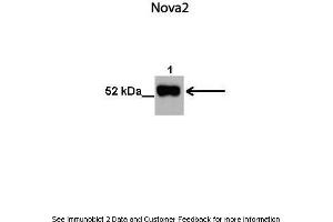 Lanes:   1. (NOVA2 anticorps  (N-Term))