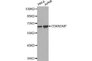 Western blot analysis of extracts of various cell lines, using CDKN2AIP antibody. (CDKN2AIP anticorps  (AA 1-220))