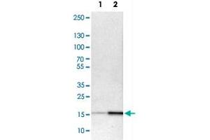 Western Blot analysis of Lane 1: NIH-3T3 cell lysate (mouse embryonic fibroblast cells) and Lane 2: NBT-II cell lysate (Wistar rat bladder tumour cells) with ACP1 polyclonal antibody . (ACP1 anticorps)