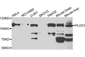 Western blot analysis of extracts of various cell lines, using PLOD1 antibody (ABIN5975225) at 1/1000 dilution. (PLOD1 anticorps)