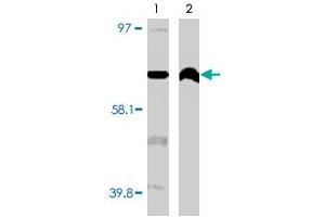 Western blot using CYP4F11 monoclonal antibody, clone F21 P6 F5  on normal (1) and cancerous (2) kidney cell lysates. (CYP4F11 anticorps  (C-Term))