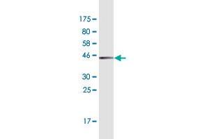Western Blot detection against Immunogen (45.