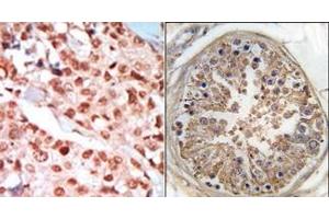 Image no. 1 for anti-Protein Kinase, AMP-Activated, gamma 1 Non-Catalytic Subunit (PRKAG1) (Middle Region) antibody (ABIN359117)