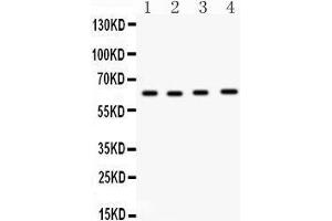 Western Blotting (WB) image for anti-Cell Division Cycle 6 Homolog (S. Cerevisiae) (CDC6) (AA 147-549) antibody (ABIN3043500)