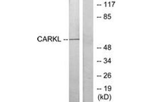 Western blot analysis of extracts from Jurkat cells, using CARKL Antibody. (SHPK anticorps  (AA 31-80))