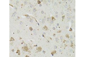 Immunohistochemistry of paraffin-embedded Mouse brain using PTPN3 Polyclonal Antibody at dilution of 1:100 (40x lens). (PTPN3 anticorps)