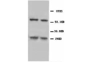 Image no. 1 for anti-BCL2/adenovirus E1B 19kDa Interacting Protein 3 (BNIP3) (N-Term) antibody (ABIN1493042) (BNIP3 anticorps  (N-Term))