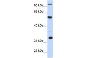 Image no. 1 for anti-Apolipoprotein B mRNA Editing Enzyme, Catalytic Polypeptide 1 (APOBEC1) (N-Term) antibody (ABIN6742971) (APOBEC1 anticorps  (N-Term))