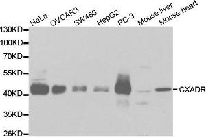 Western Blotting (WB) image for anti-Coxsackie Virus and Adenovirus Receptor (CXADR) antibody (ABIN1872126) (Coxsackie Adenovirus Receptor anticorps)