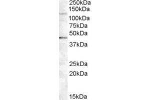 Western Blotting (WB) image for anti-Tankyrase, TRF1-Interacting Ankyrin-Related ADP-Ribose Polymerase 2 (TNKS2) (Internal Region) antibody (ABIN2466779) (TNKS2 anticorps  (Internal Region))