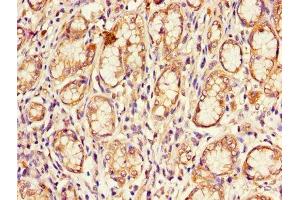 Immunohistochemistry of paraffin-embedded human stomach tissue using ABIN7148885 at dilution of 1:100 (CDKN2B anticorps  (AA 1-138))