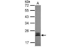 WB Image Sample (30 ug of whole cell lysate) A: A431 , 12% SDS PAGE antibody diluted at 1:3000 (RHOC anticorps)