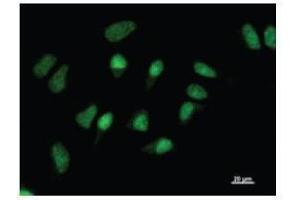 Immunostaining analysis in HeLa cells. (GATAD1 anticorps)