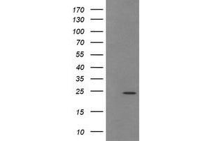 Image no. 2 for anti-Trafficking Protein Particle Complex 4 (TRAPPC4) antibody (ABIN1501265) (TRAPPC4 anticorps)