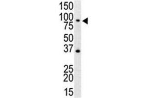 Western blot analysis of anti-TLR4 antibody and mouse spleen cell lysate