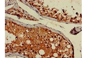Immunohistochemistry of paraffin-embedded human testis tissue using ABIN7144346 at dilution of 1:100 (gamma 1 Adaptin anticorps  (AA 592-686))