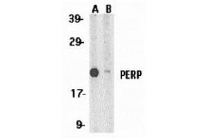 Western Blotting (WB) image for anti-TP53 Apoptosis Effector (PERP) (C-Term) antibody (ABIN1030575) (PERP anticorps  (C-Term))