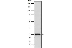Western blot analysis of TC10 expression in 293T cell lysate.