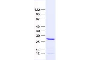 Validation with Western Blot