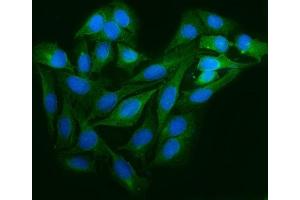 IF analysis of Astrin/Deepest/SPAG5 using anti-Astrin/Deepest/SPAG5 antibody (ABIN7602399).